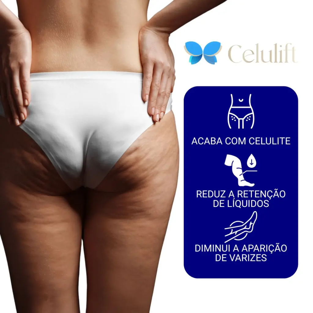 Celulift
